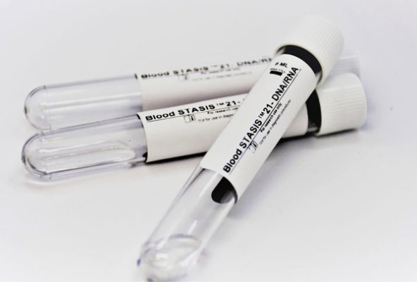 Magbio DNA Blood STASIS kit 4May22